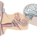 와우히어링 이미지