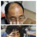 현담가발 이미지