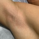 인동35길1R-5 | 🔥 구미 인동 남자왁싱 후기바프 찍는 30대 남자 고객님의 겨드랑이 + 브라질리언 왁싱 리얼후기 💪