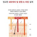스캘프 이미지