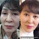 인셀덤we | 인셀덤 사용후기!!! 단계별로 살펴볼까요?