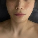 거제대로(고현동) | 거제고현피부관리 이레에스테틱 피부관리 후기