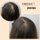 다전헤어라인 | [전주 채우다] 전주 탈모관리 두피관리 피부관리 SMP 탈모커버 두피채움 헤어라인 자연눈썹 아이라인