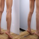 세이지의원 | 초음파 기반 하체비만 지방질량 예측 모델 공개 - 다리성형 빅데이터 세이지의원
