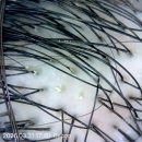 힐링헴프 | 아크닛 스케일링 헤드스파로 스트레스 싹 다 날리고 왔음,,@소브에스테틱스파 강추