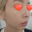 품절대란 리쥬비넥스 대체제로 리쥬올 PDRN 리페어크림 가격 비교 효능 후기