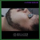 스노우의원대전둔산 네이버블로그