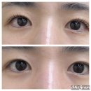 골다 | 코골다보면 완성되는 사당 속눈썹펌 후기 Feat. 사당속눈썹잘하는곳아이듀