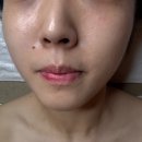 노원역3번출구 | 노원역피부관리 추천, 나만을 위한 맞춤형 관리 후기