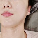 찡뷰티 | 전주에스테틱 찡뷰티 ESV10 피부관리 후기