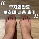 무지외반증교정기 사용 후기, 힐스템 엄지발가락 교정기 고정밴드 착용해봤어요