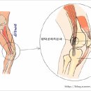 [장경인대염]이라고 하네요~ 석민이형님도 이 증상이신듯~ 이미지