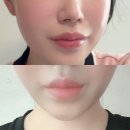 압구정찜질방사우나 | 압구정역피부과 다운타임 짧은 티타늄리프팅 통증, 프라이빗한 단독룸 관리 솔직후기