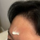 클린클로버강화점 | 💁🏻남자친구 20대 만들기 1️⃣ 여드름 흉터 [이즈그린 LHA 비건 에센스]
