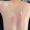 약봉테라피(마사지교정운동) | 마곡 마사지 바로테라피 마곡본점｜승모근 체형교정 등 프리미엄 컨디셔닝 후기