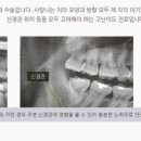 참좋은치과의원 네이버블로그