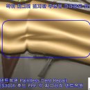 크라운덴트 이미지