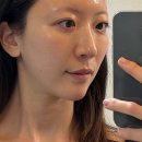 90일의기적의원 | 90일의기적 엑소좀 리바이탈라이징 크림 화장품 내돈내산 후기