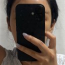 빨간여우 | 성형 일기 - 눈꼬리 리프팅/여우눈 성형/여우눈 리프팅 후기