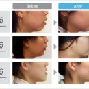 치아나라치과의원 이미지