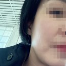 AK플라자 원주점(지하3층) | 원주무실동피부과 원주리쥬란힐러 찐 후기 리쥬란효과 리쥬란흉터