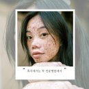 스노우의원마곡점 | 잡티 제거 리팟레이저 전문으로하는피부과 효과있는 마곡 스노우의원 관리후 병원 화장품 재생크림 추천