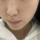 수원 인계동 온다리프팅 얼굴온다 이브시너지 내돈내산 후기