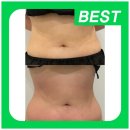 나를 위한 셀프피부관리 이미지