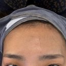 익산초등학교 | 익산피부관리 어썸웰스파 2호점 프리미엄관리 받고 온 후기