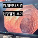 바른카 | 연신내바른내과 후기｜위·대장내시경 검사 다녀왔어요!_내돈내산_박간호사