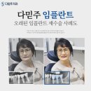 부산치과 잘하는곳 치료후기 확인하자