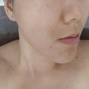 성서설레임뷰티 | 달서구 피부관리실 브리앙슈 에스테틱 트로이필 후기