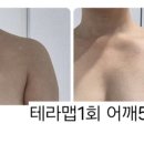 조이디바이스 이미지