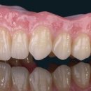 다이아몬드치과기공소 이미지