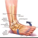 발목염좌(발목 접질렸을때) 응급처치| 이미지