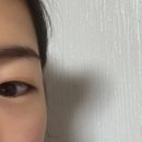 아이컨텍성형외과의원 이미지