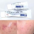 성화약국 | 주사피부염 수란트라 한달차 후기 | 붉은기•트러블 진정 변화