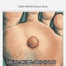 RR-97[번영로]-상-7 | 사마귀 냉동치료 후기를 찾기 전에 — 사마귀, 뿌리뽑는 병이 아닙니다 | 피부과전문의