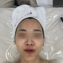 승현개발 | W5-8. 피부관리 :: 마곡역 에스테틱 벨로즈뷰티 미백관리 후기