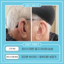 대전보장구센터 | 대전 태평동 보청기, 이 XX 고객님 오티콘 MORE 1 정부지원보청기 구매후기(80대, 男)