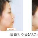 오렌지성형외과