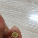 문제성 손발톱 전문관리 케어톱톱 | 인천발톱무좀병원 문제성발톱병원 치료 관리 후기ㅣ남편 발톱무좀 때문에 다녀왔어요