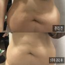 하나은행 목동지점 앞 | 목동역헬스장 고도비만 쥬비스목동점 1주 차 쥬비스다이어트 후기