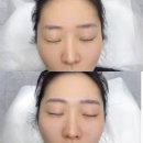 리피움 | 똥손을 위한 전포브로우리프트 리피움 후기