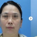 케이톡스의원 인천구월점 이미지