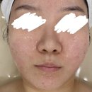 예쁜피부관리실 | 의정부 에스테틱 마사지 추천 늘예쁜에스테틱 스노우테라피 피부관리 후기