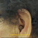 일산서울보청기 오창준보청기연구소 이미지