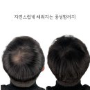 탈모왕 대구점 이미지
