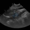 부신메디칼 이미지