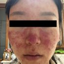 머리하기기쁜날 | 꾸미 출산일기 :: 우리기쁜산부인과 제왕절개 4박5일 입원 후기